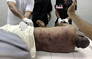 Bahrain: Is a U.S. Ally Using Torture to Put Down Dissent?