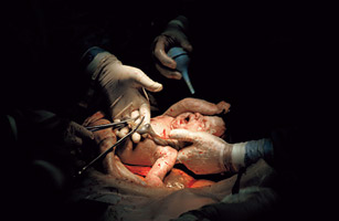 How Saving Your Babys Umbilical Cord Can Save Lives