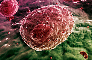 Bone Marrow Transplants: When Race Is an Issue