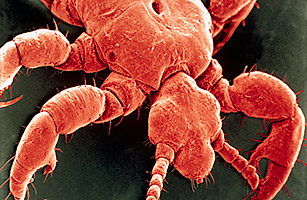 School Head-Lice Policies Must Be Relaxed, Say Doctors