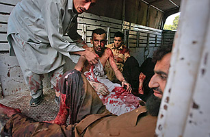 Blasts Kill 34 in Pakistan, Injure 100