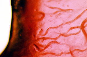 Could Worms Deep Below Earth Mean Theres Life in Space?