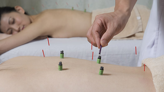 Acupuncture for Bad Backs: Even Sham Therapy Works