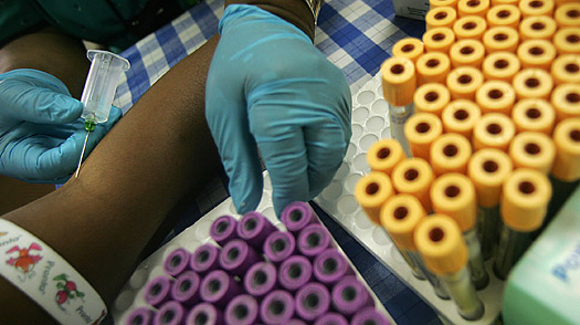 Pills Prevent HIV in Straight Men and Women