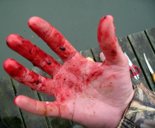 Man cuts out own intestines to use as weapon against police